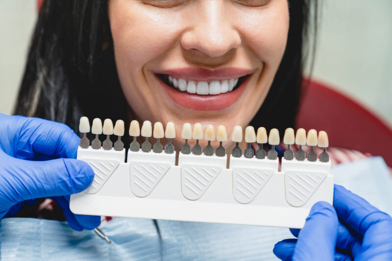 cosmetic dentist holding veneers for patient to chose color