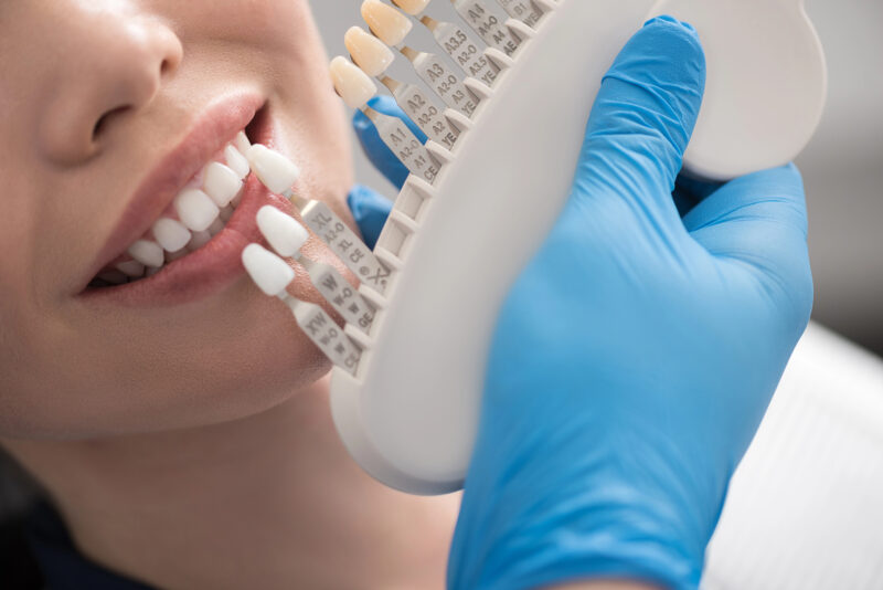 young woman selecting the shades of CEREC crowns