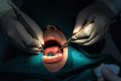 patient's mouth open - dentist seeing if good candidate for dental bridge procedure 