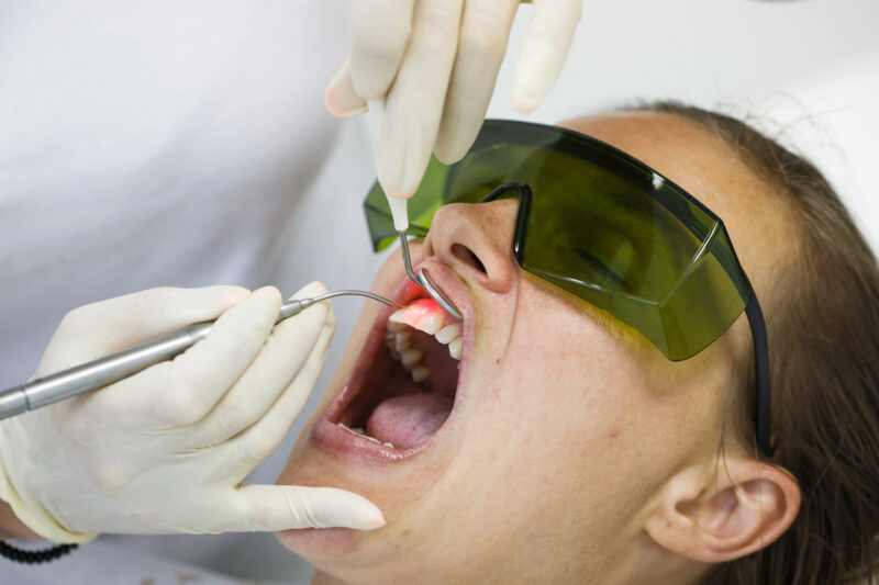 lanap procedure - laser gum therapy for gum disease