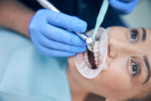 woman receiving dental bonding for front teeth 